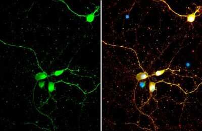 Immunocytochemistry/ Immunofluorescence: SMCR8 Antibody [NBP3-13411]