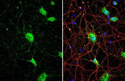 Immunocytochemistry/ Immunofluorescence: SMCR8 Antibody [NBP3-13413]