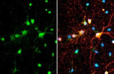 Immunocytochemistry/ Immunofluorescence: SMCR8 Antibody [NBP3-13413]