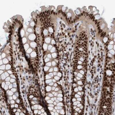 Immunohistochemistry-Paraffin: SMCR8 Antibody [NBP1-93833]