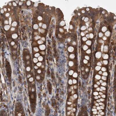 Immunohistochemistry-Paraffin: SMCR8 Antibody [NBP1-93834]