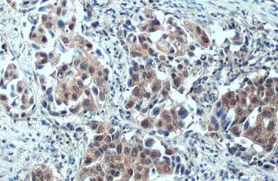 Immunohistochemistry-Paraffin: SMCR8 Antibody [NBP3-13413]