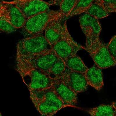 Immunocytochemistry/ Immunofluorescence: SMCX Antibody [NBP2-55009]