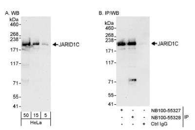 Western Blot: SMCX Antibody [NB100-55328]