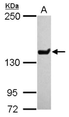 Western Blot: SMCX Antibody [NBP2-20422]