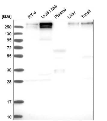 Western Blot: SMCX Antibody [NBP2-55541]