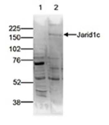 Western Blot: SMCX Antibody [NBP3-18659]