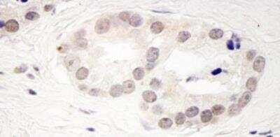 Immunohistochemistry-Paraffin: SMEK2 Antibody [NB100-2881]