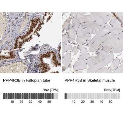 Immunohistochemistry-Paraffin: SMEK2 Antibody [NBP1-83882]