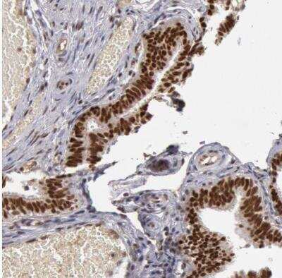 Immunohistochemistry-Paraffin: SMEK2 Antibody [NBP1-83882]