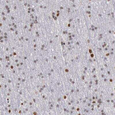 Immunohistochemistry-Paraffin: SMEK2 Antibody [NBP1-83882]