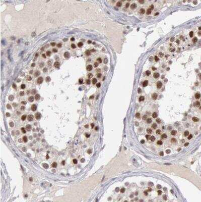 Immunohistochemistry-Paraffin: SMEK2 Antibody [NBP1-83882]
