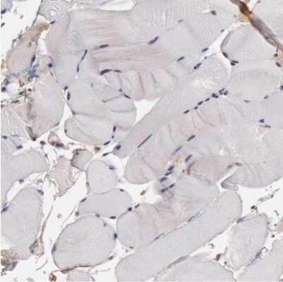 Immunohistochemistry-Paraffin: SMEK2 Antibody [NBP1-83882]