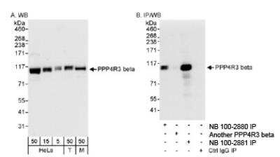 Western Blot: SMEK2 Antibody [NB100-2881]