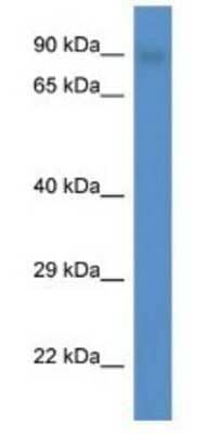 Western Blot: SMEK2 Antibody [NBP1-79673]