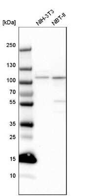 Western Blot: SMEK2 Antibody [NBP1-83882]