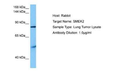 Western Blot: SMEK2 Antibody [NBP2-88315]