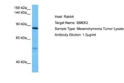 Western Blot: SMEK2 Antibody [NBP2-88316]