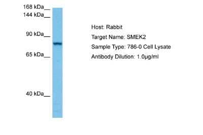 Western Blot: SMEK2 Antibody [NBP2-88317]