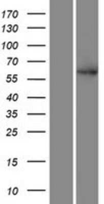 Western Blot: SMEK2 Overexpression Lysate [NBP2-06643]