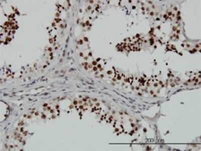 Immunohistochemistry-Paraffin: SMG1 Antibody (1A8) [H00023049-M02]