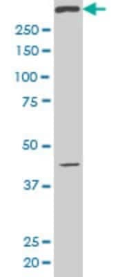 Western Blot: SMG1 Antibody (1A8) [H00023049-M02]