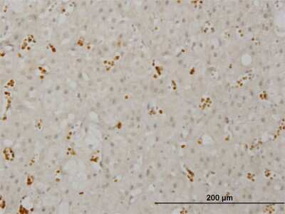 Immunohistochemistry-Paraffin: SMG1 Antibody (1C12) [H00023049-M03]