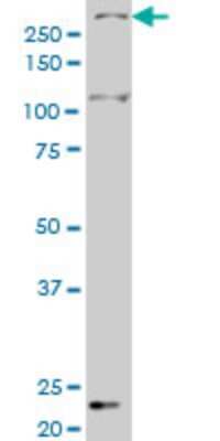 Western Blot: SMG1 Antibody (1C12) [H00023049-M03]