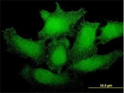 Immunocytochemistry/ Immunofluorescence: SMG1 Antibody (1G5) [H00023049-M01]