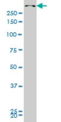 Western Blot: SMG1 Antibody (4E4) [H00023049-M05]