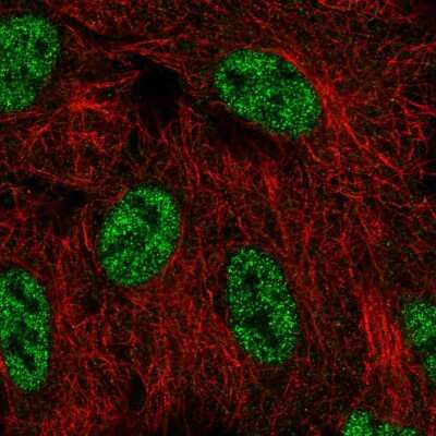 Immunocytochemistry/ Immunofluorescence: SMG1 Antibody [NBP2-55889]