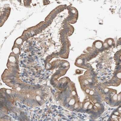 Immunohistochemistry-Paraffin: SMG1 Antibody [NBP1-88913]