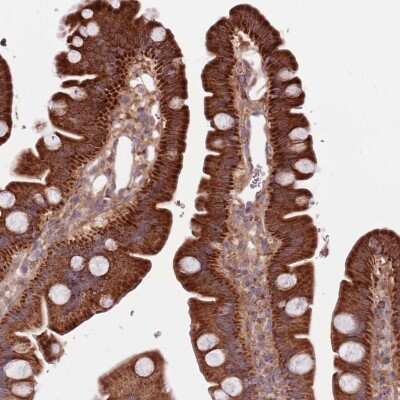 Immunohistochemistry-Paraffin: SMG1 Antibody [NBP2-37870]