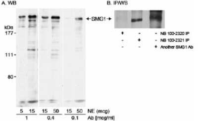 Western Blot: SMG1 Antibody [NB100-2320]