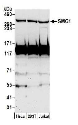 Western Blot: SMG1 Antibody [NB100-2321]