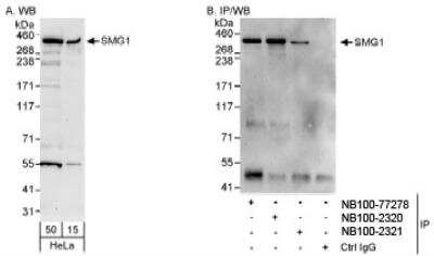 Western Blot: SMG1 Antibody [NB100-77278]