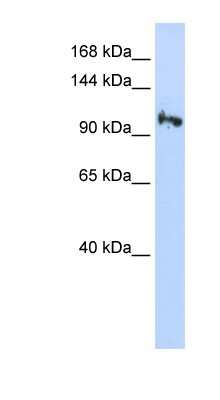 Western Blot: SMG5 Antibody [NBP1-56778]