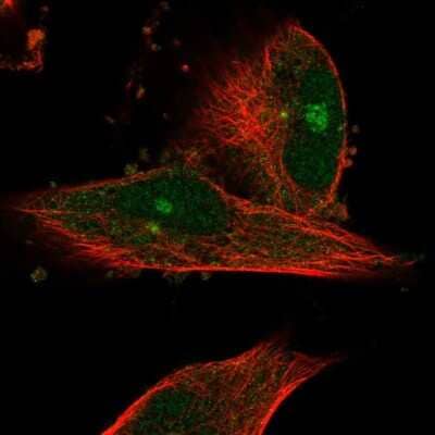 Immunocytochemistry/ Immunofluorescence: SMG6 Antibody [NBP1-92410]