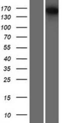 Western Blot: SMG6 Overexpression Lysate [NBP2-06966]