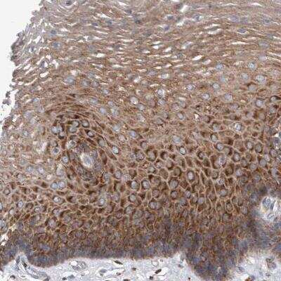 Immunohistochemistry-Paraffin: SMG7 Antibody [NBP1-88486]