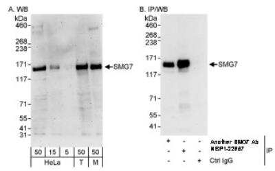 Western Blot: SMG7 Antibody [NBP1-22967]