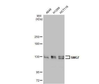 Western Blot: SMG7 Antibody [NBP2-20423]