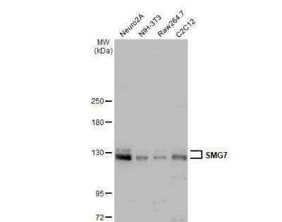 Western Blot: SMG7 Antibody [NBP2-20423]