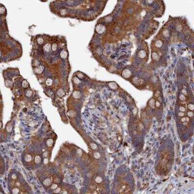 Immunohistochemistry: SMG9 Antibody [NBP2-13355]