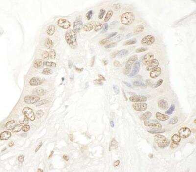 Immunohistochemistry-Paraffin: SMG9 Antibody [NBP1-26595]