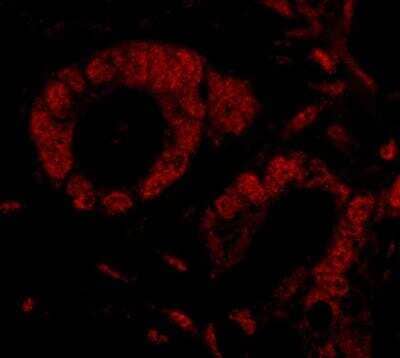 Immunohistochemistry-Paraffin: SMG9 Antibody [NBP1-26595]