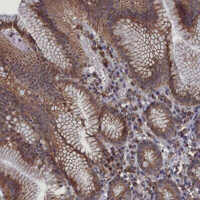 Immunohistochemistry-Paraffin: SMG9 Antibody [NBP2-13354]