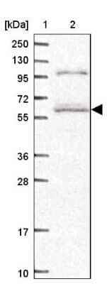 Western Blot: SMG9 Antibody [NBP2-13354]