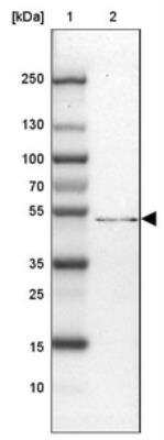 Western Blot: SMG9 Antibody [NBP2-13355]