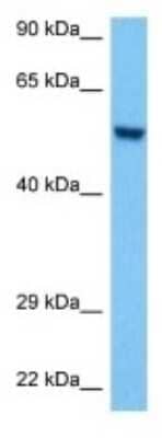 Western Blot: SMG9 Antibody [NBP3-10278]